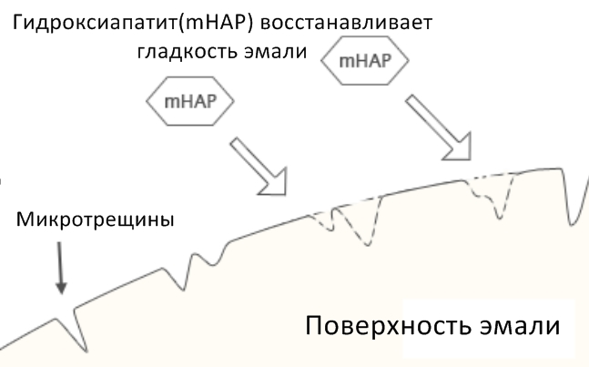 Гідроксіапатит